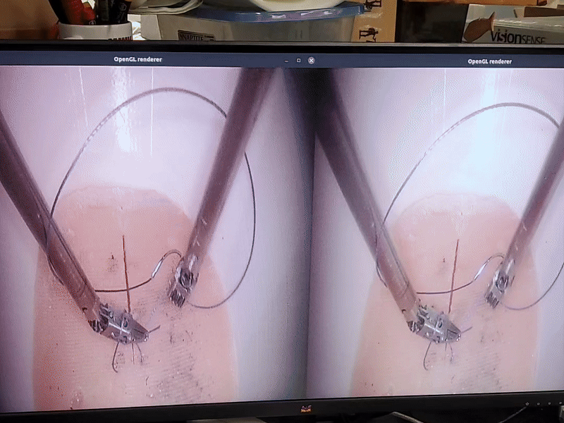 Suture Gif